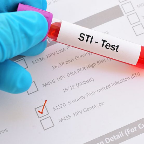 Eine Hand hält einen STI-Test über einem Formular.